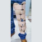 Knee Immobilizer