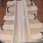 Knee Immobilizer